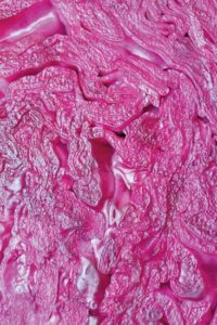 Sauerkraut Steak Recipe Image